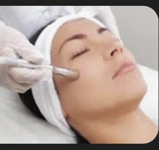 Microdermabrasion