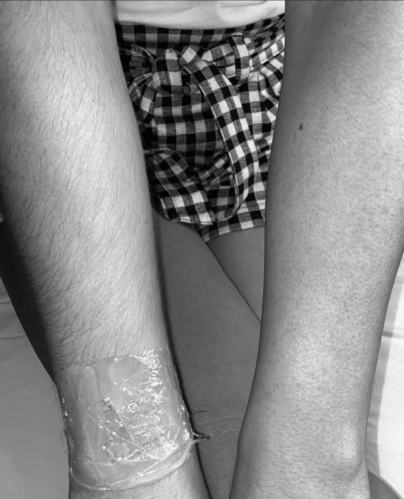 Full Arm Wax