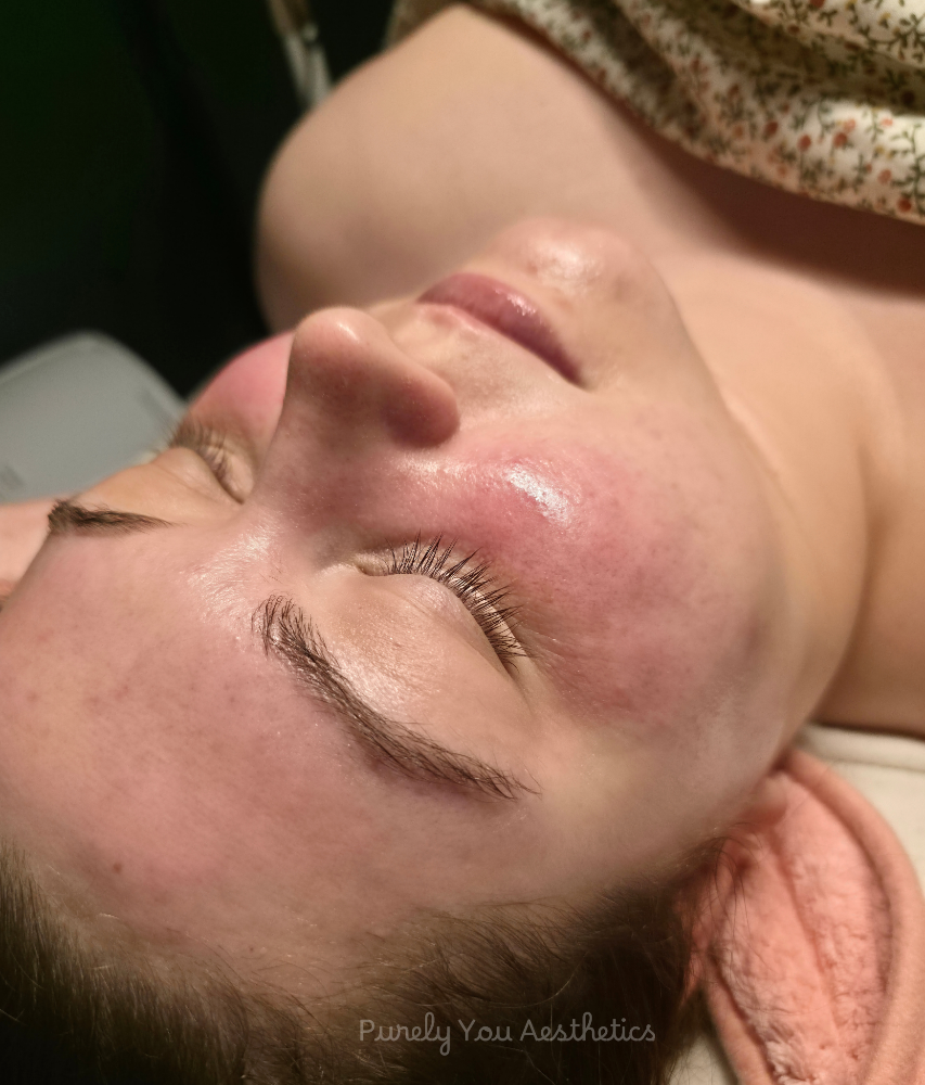 Custom Facials