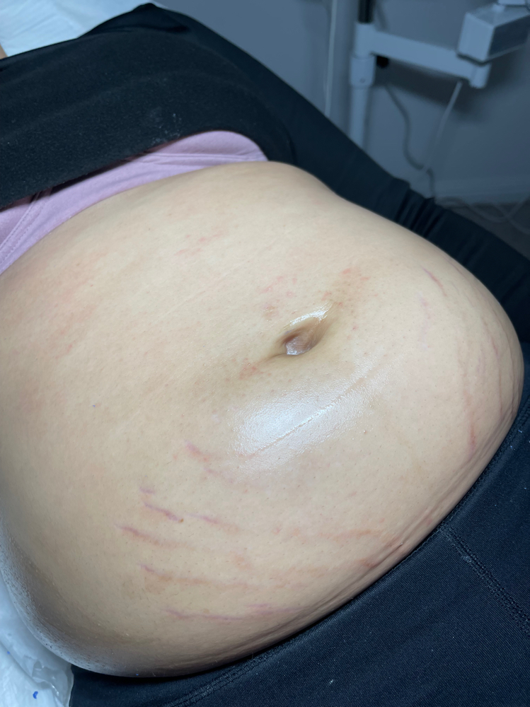 Belly Bump Wax & Glow