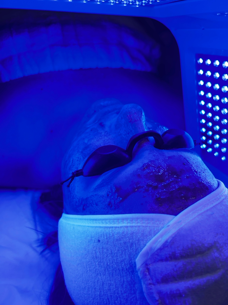 LED Light Therapy