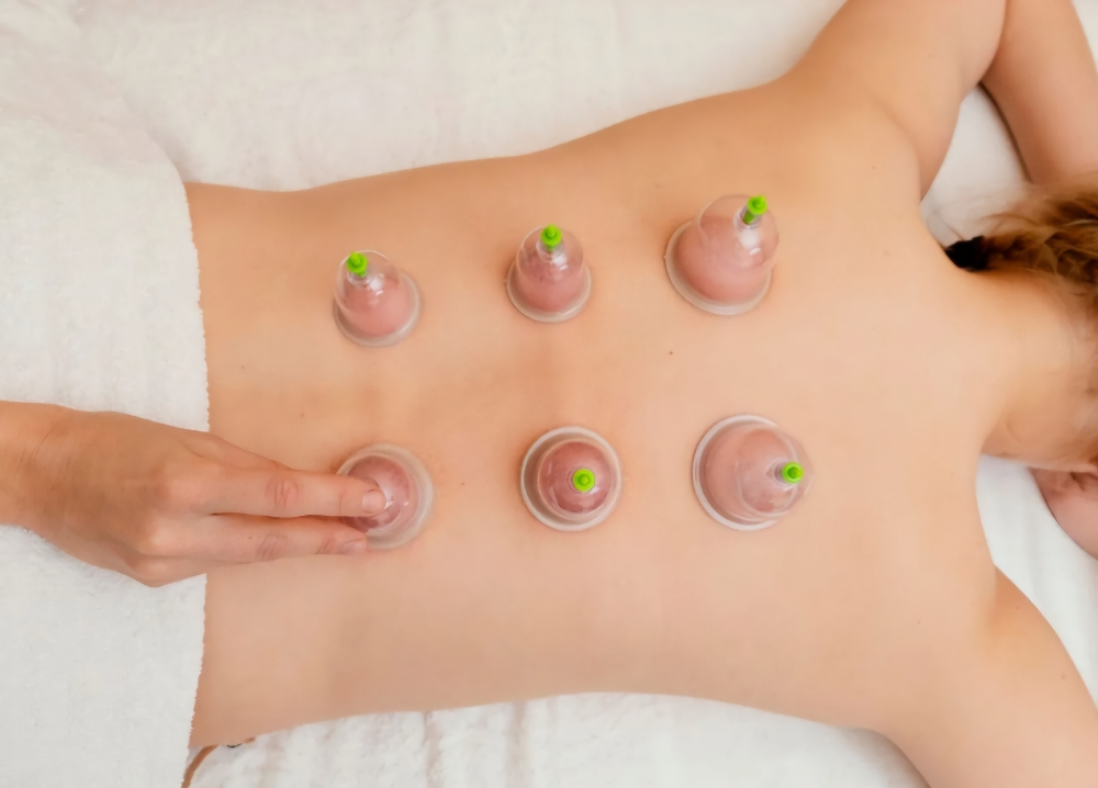 Body Cupping - add on