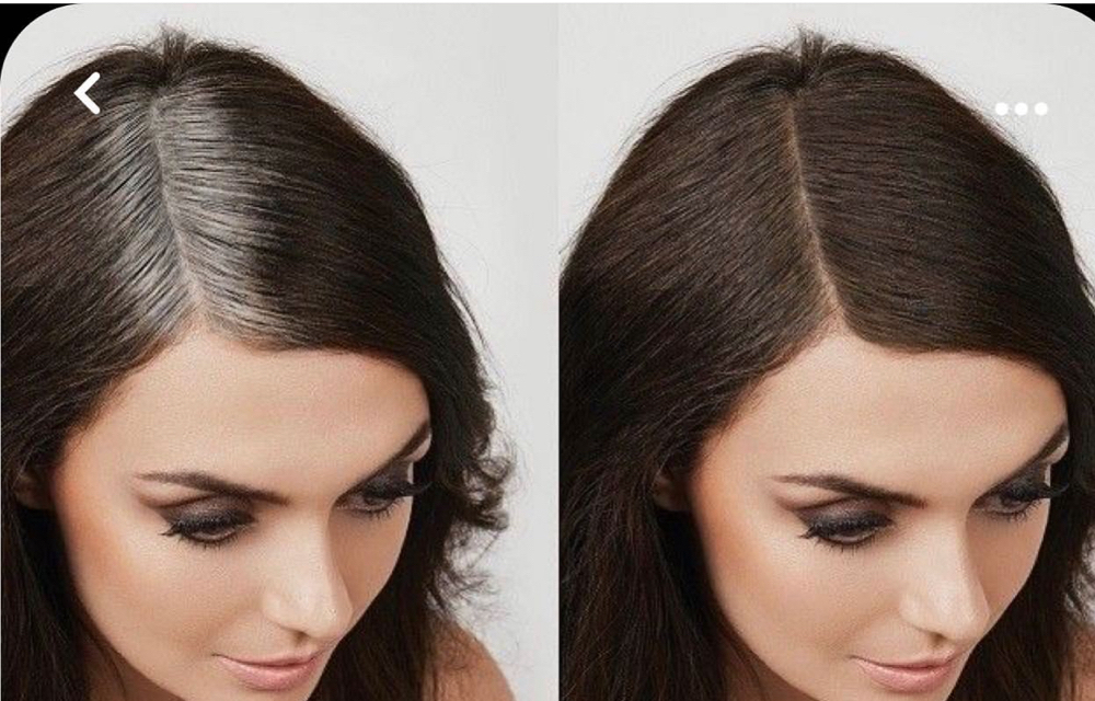 Root Touch And Dash
