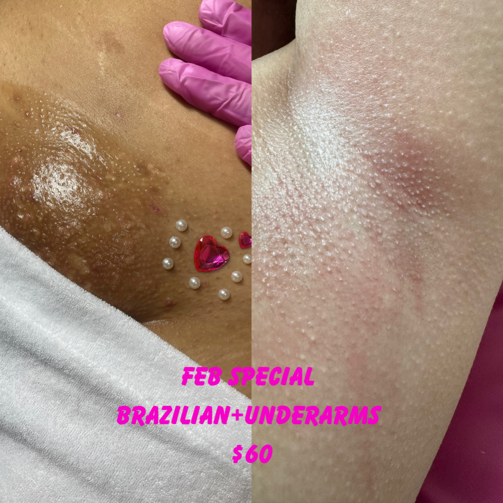 Brazilian And Armpit Feb Special