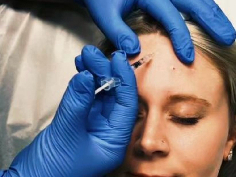 Neurotoxin Anti-wrinkle Treatments