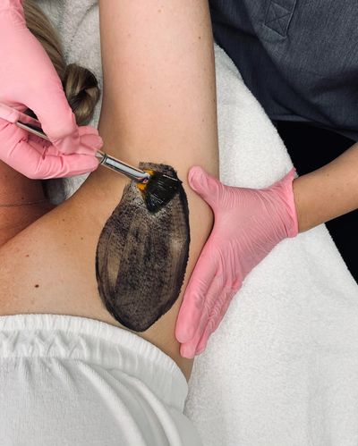 Underarm Detox Treatment
