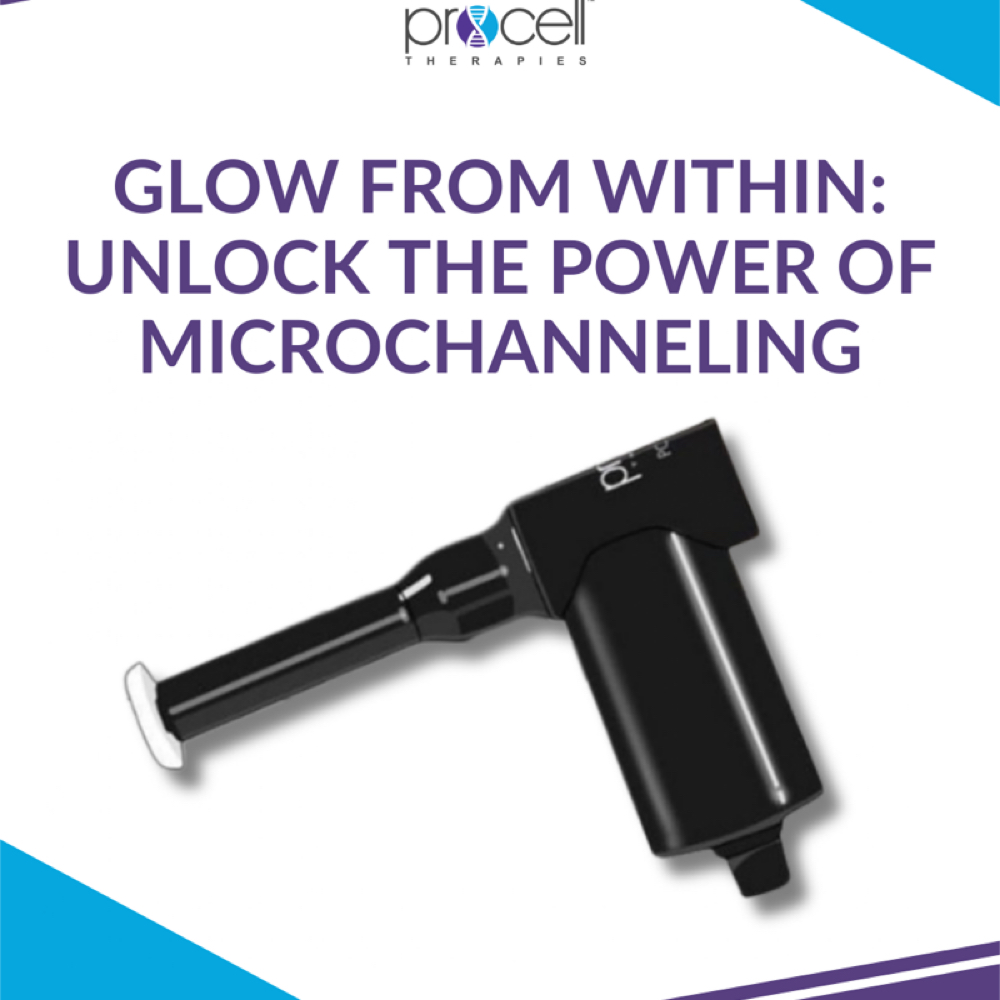 Series Of 3 Microchanneling at D’Olive Skin Therapy in League City, TX