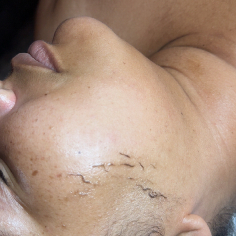 Dermaplaning Facial at Bodied By Takis in Ridgeland, MS