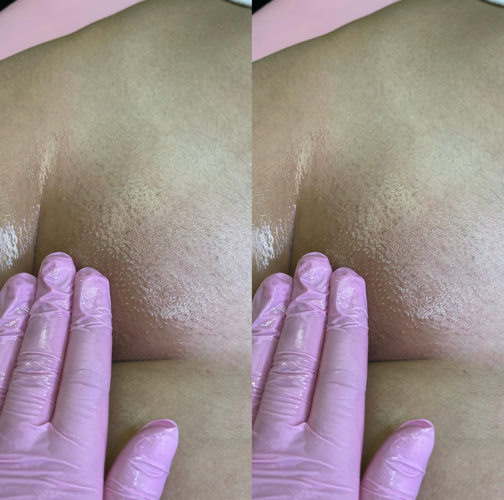 New Client Brazilian Wax