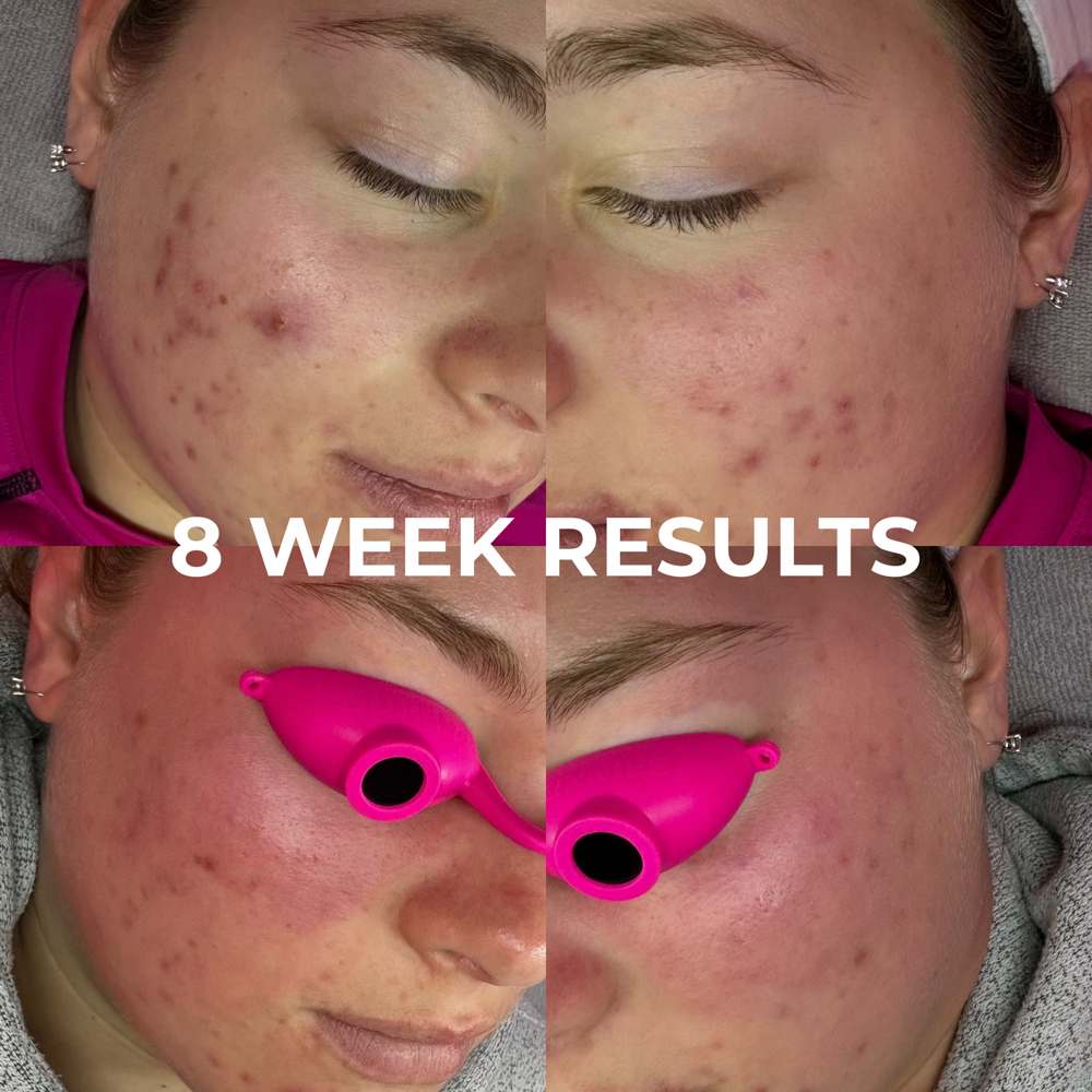 PHYTATOX at Cherrie Darling Beauty in Bethel, CT