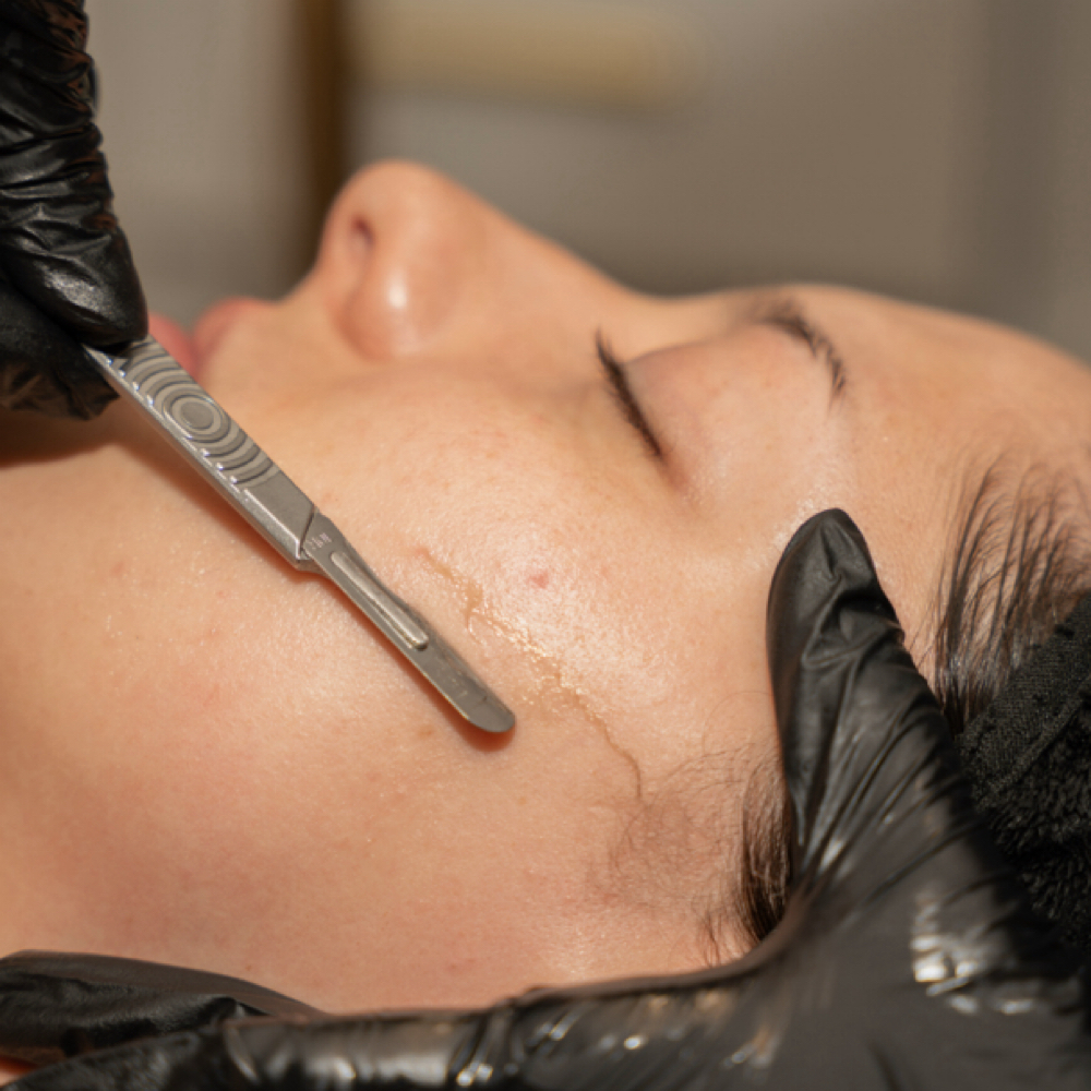 Dermaplaning at Skin By T Aesthetics in Waterford Works, NJ