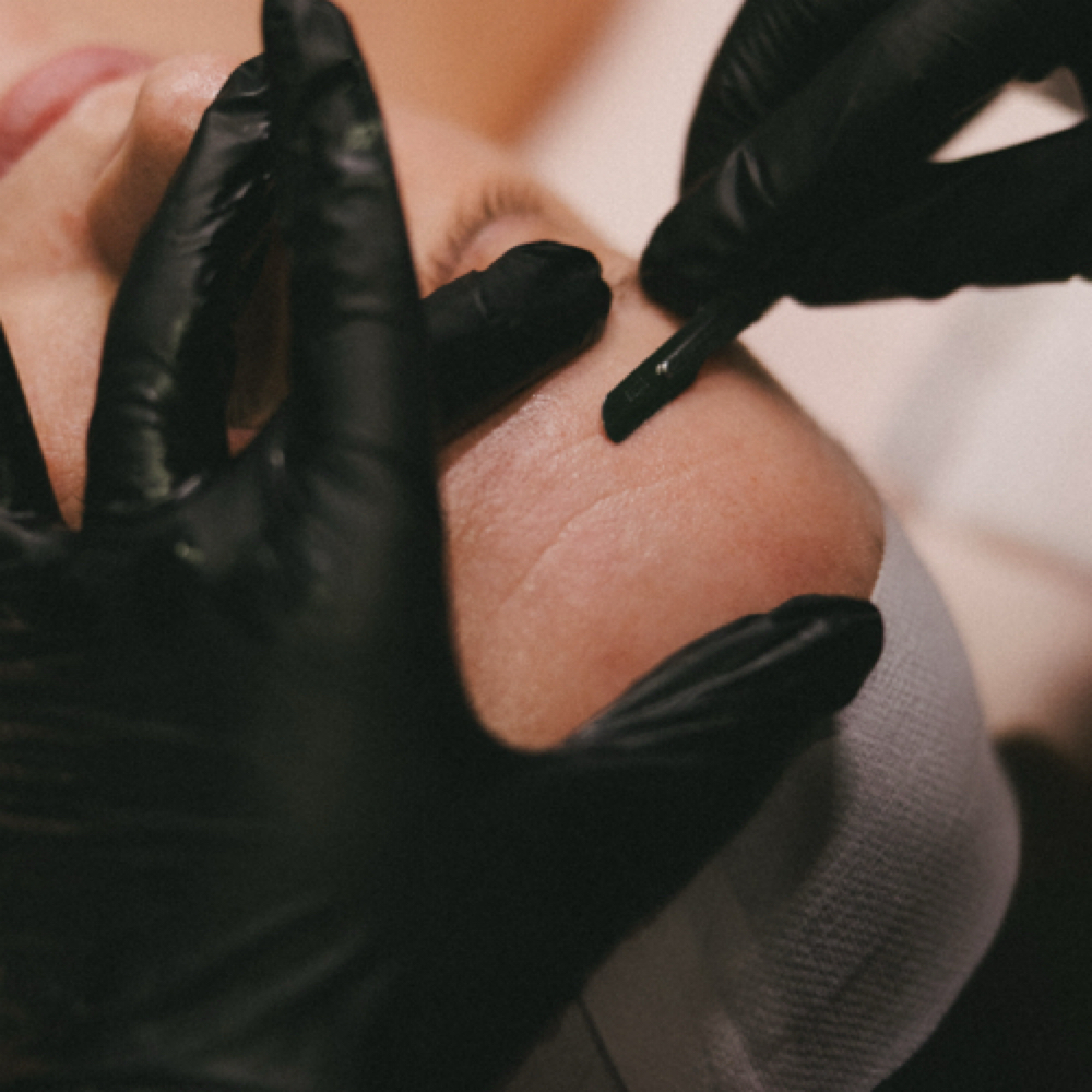 Dermaplane at Royal Esthetics in Kearney, NE