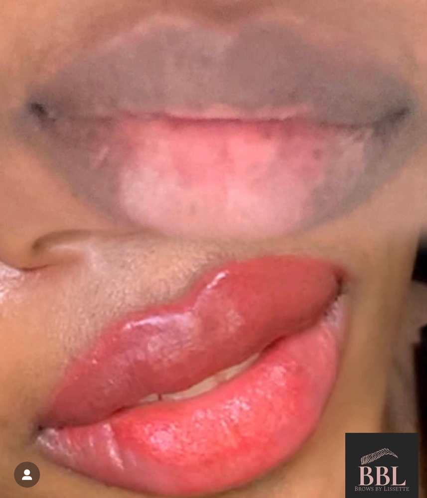 Lip Neutralization