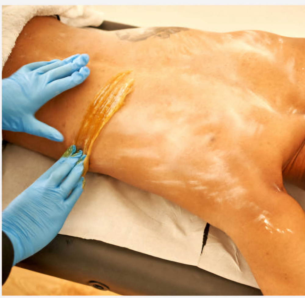 Back: Hair Removal Men