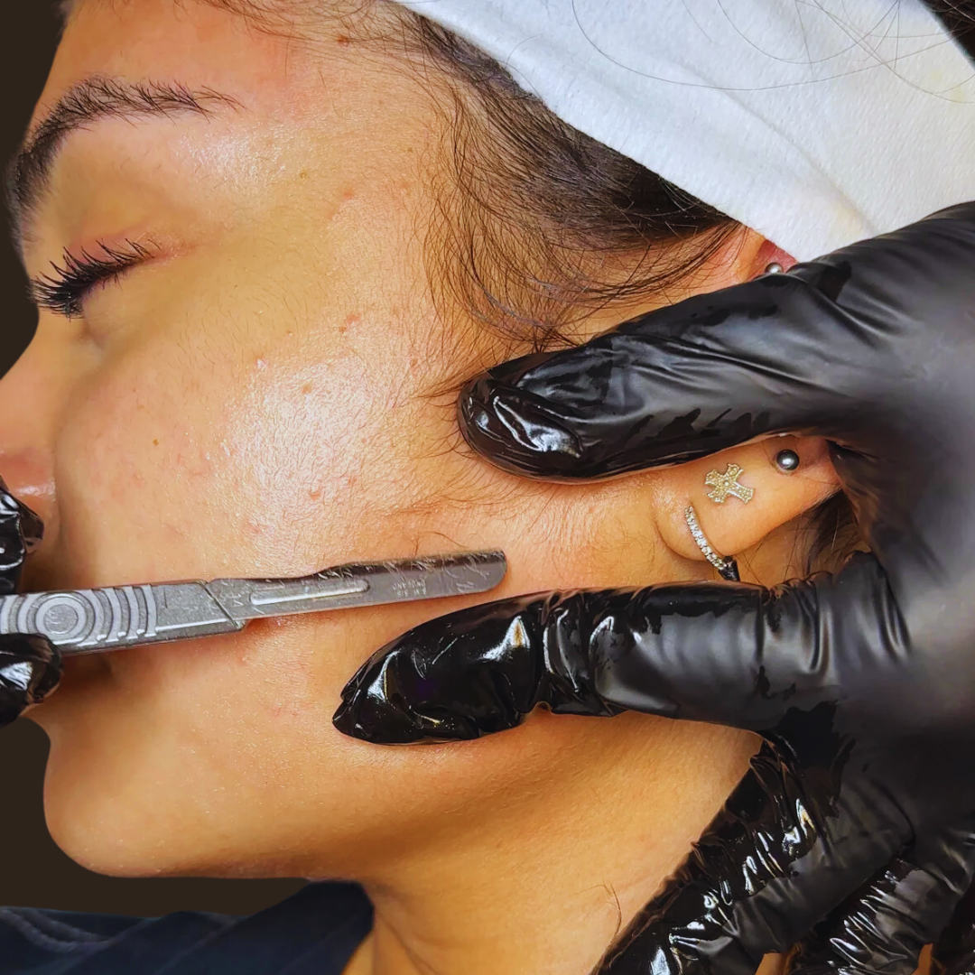 KierSKIN Dermaplaning Facial