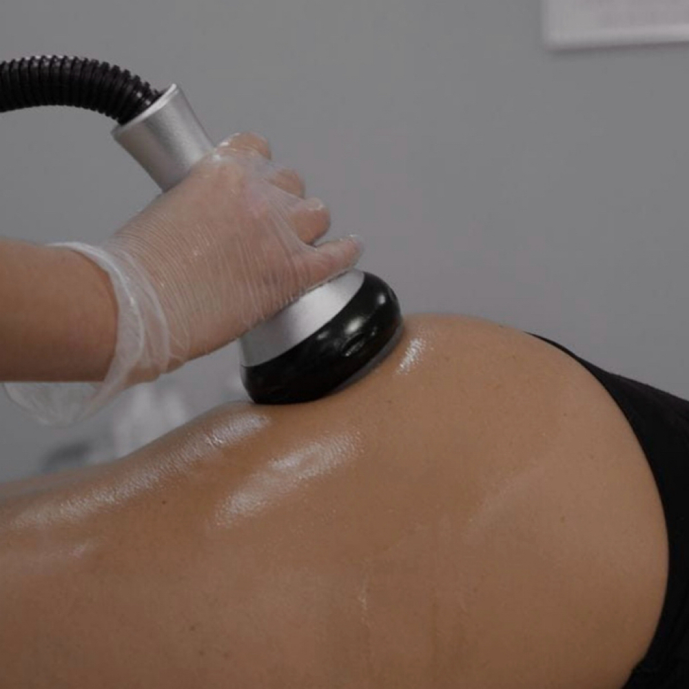 Radio Frequency Legs at Blissful Moments by Kat in Glendora, CA