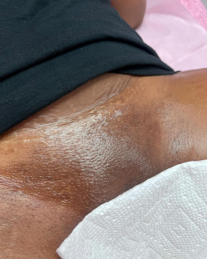 Brazilian Wax + Inner Thigs