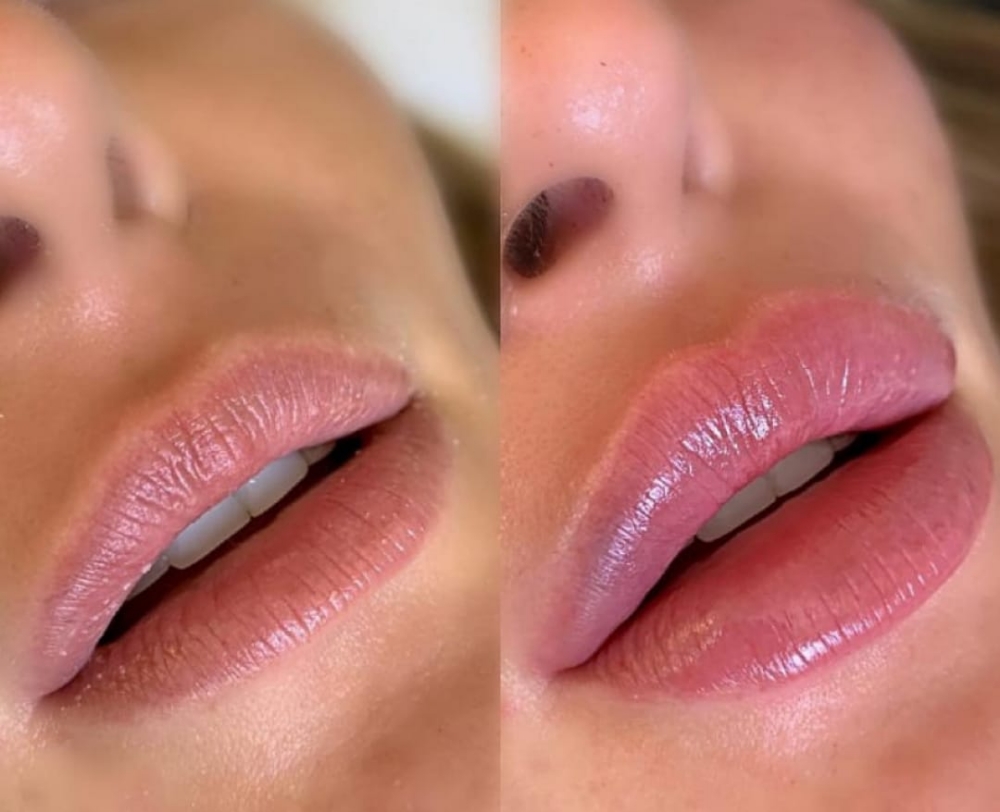 R&B Collagen Lip Mask