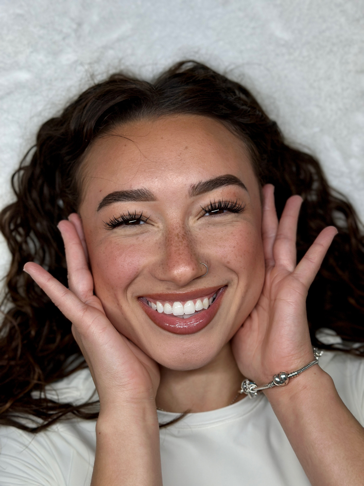 New Client Fill / Foregin Fill at The Cynn Aesthetic in Tampa, FL