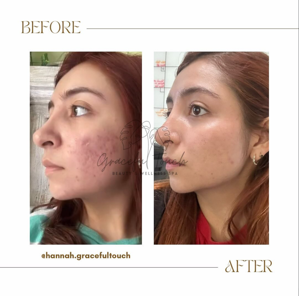 Graceful Clear Transformation