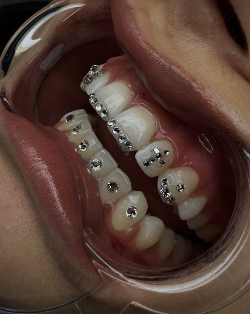 Tooth Gems at Joslyn’s Beauty Studio in Des Moines, IA