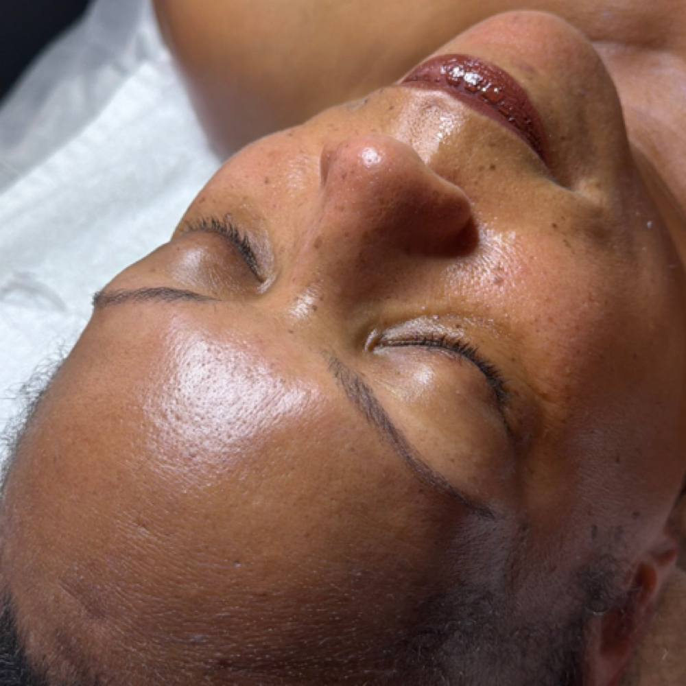 Halo Glow at Halo & Co Esthetics in San Antonio, TX
