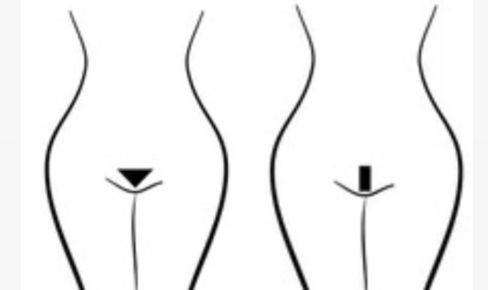 Extended Bikini at Smooth Peach Waxing Studio LLC in Harlingen, TX