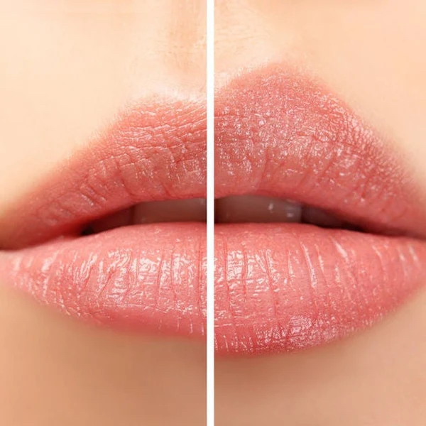 Hydra Lip Plump