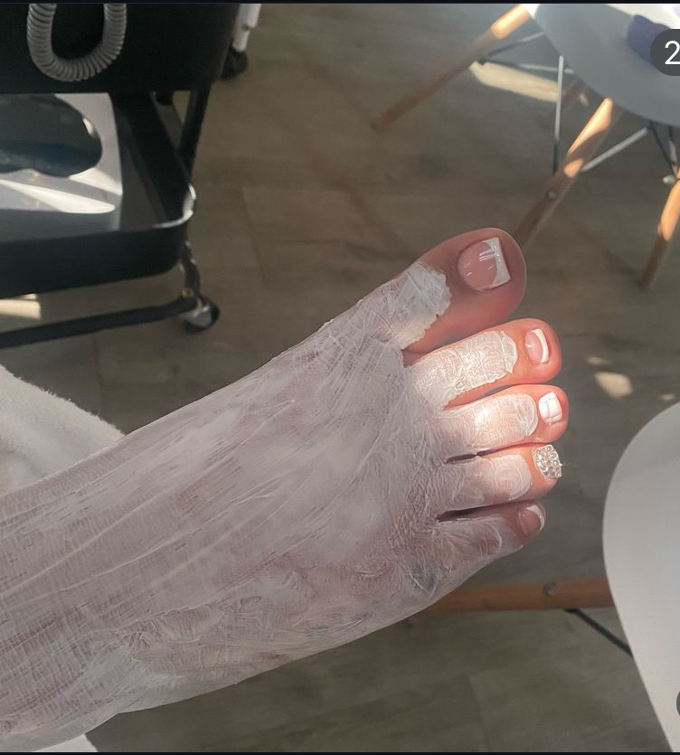 Acrylic on Big toes