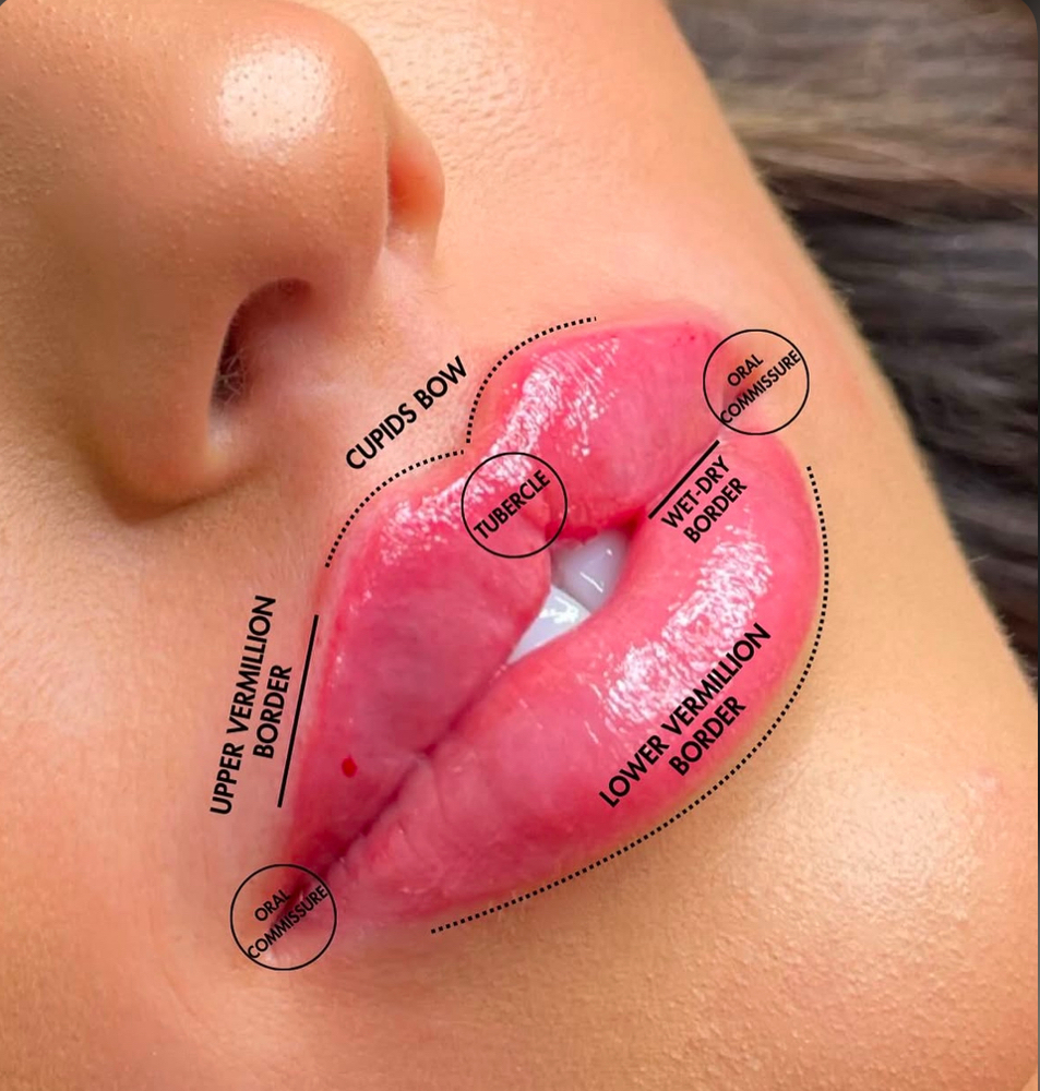 Russian Lip Filler Follow Up at Royale Aesthetic Medicine & Wellness in Cheyenne, WY