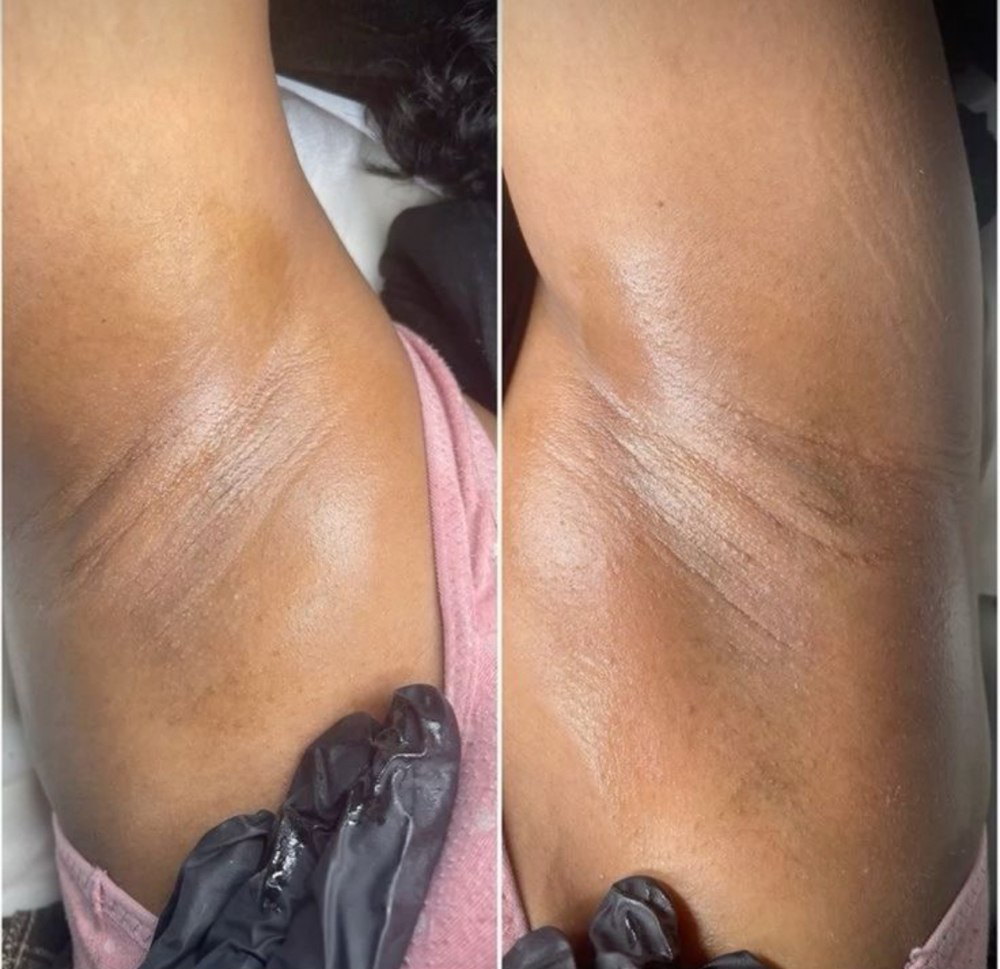Underarm Wax
