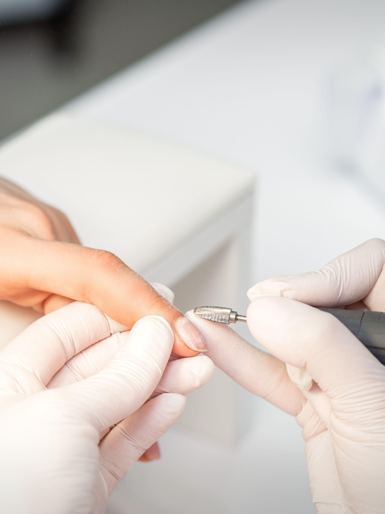 Structured Gel Overlay Removal