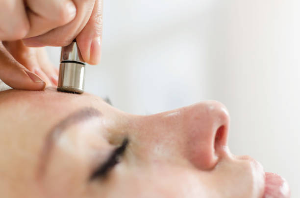 Diamond Microdermabrasion Facial