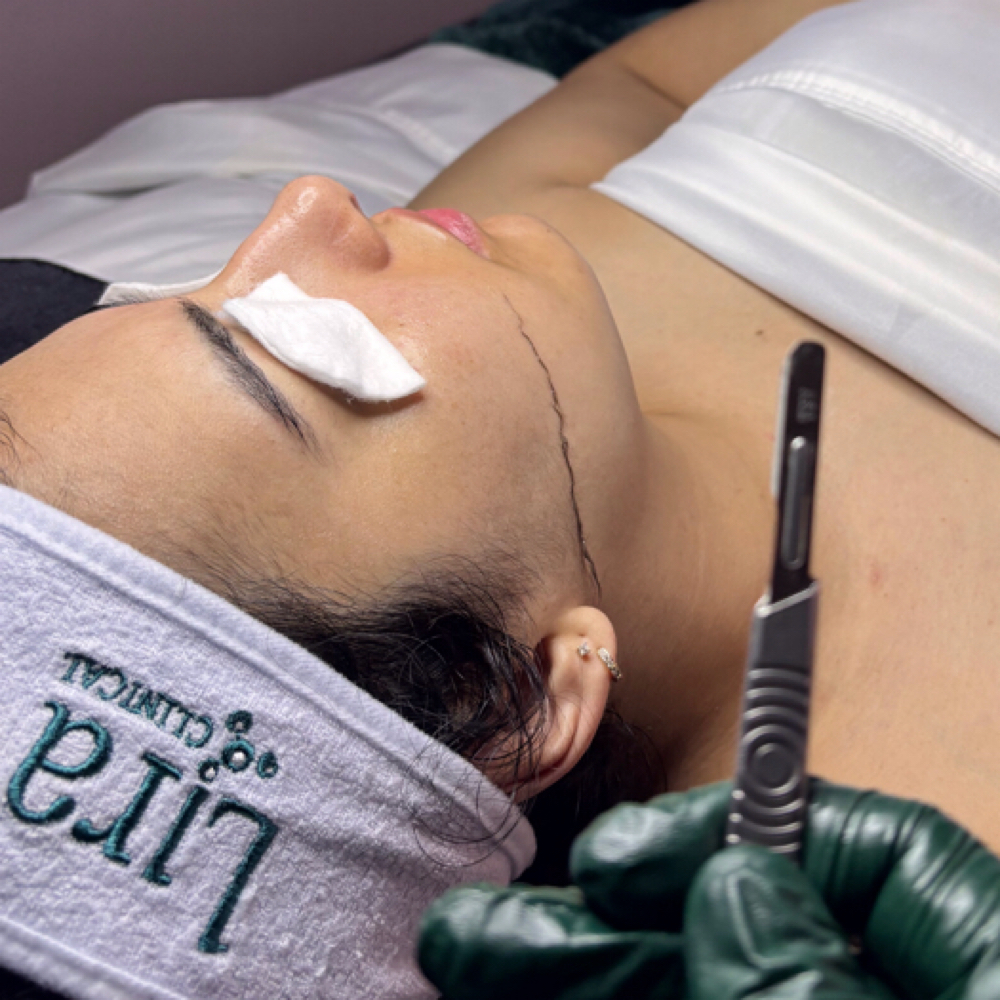 Dermaplane Signature Facial at Carmelas Skin Lounge LLC in West Valley City Utah, UT