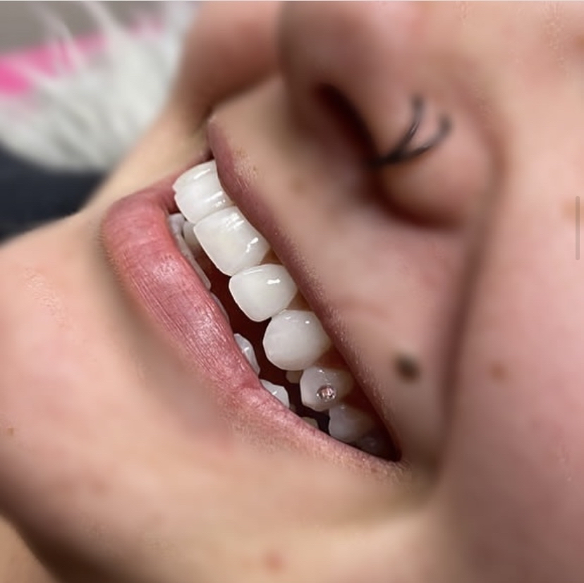Tooth Gems at Christina’s Cosmetics in Jerome, ID