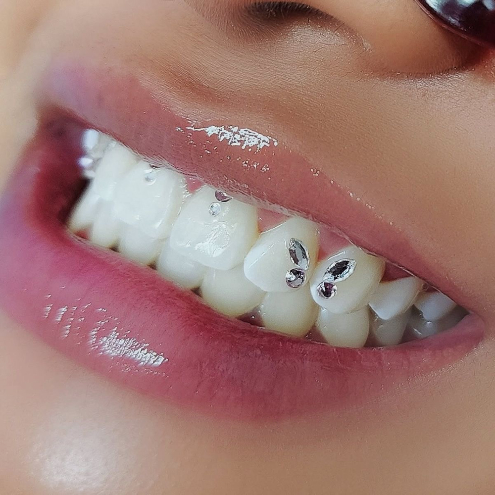 2 BUTTERFLY TOOTH GEMS