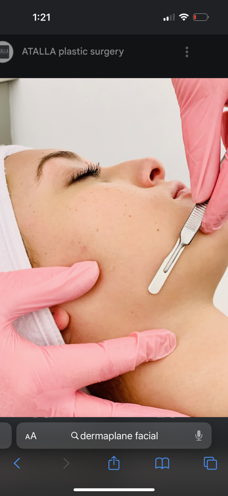 Dermaplane at DesireBeautyLab in Santan Valley, AZ