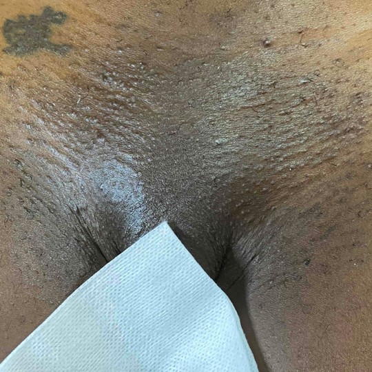 BRAZILIAN WAX