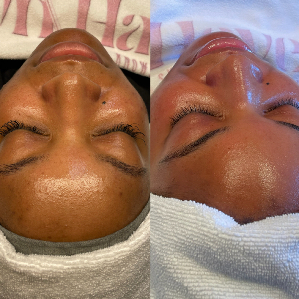 Signature Brighten & Renew Facial