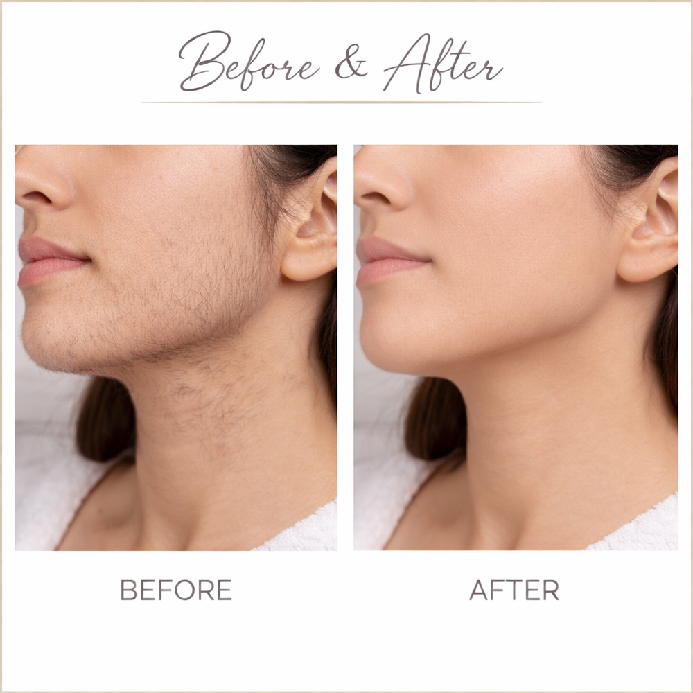 Signature Facial Wax(without Brows) at OC Aesthetics Lounge in Lake Forest, CA