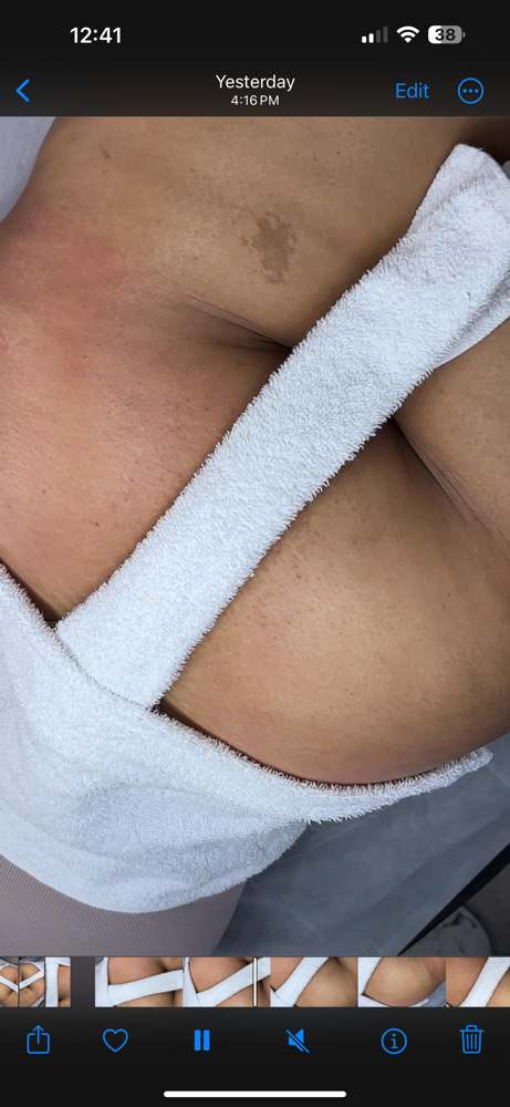 MicrodermaBOOTY Facial