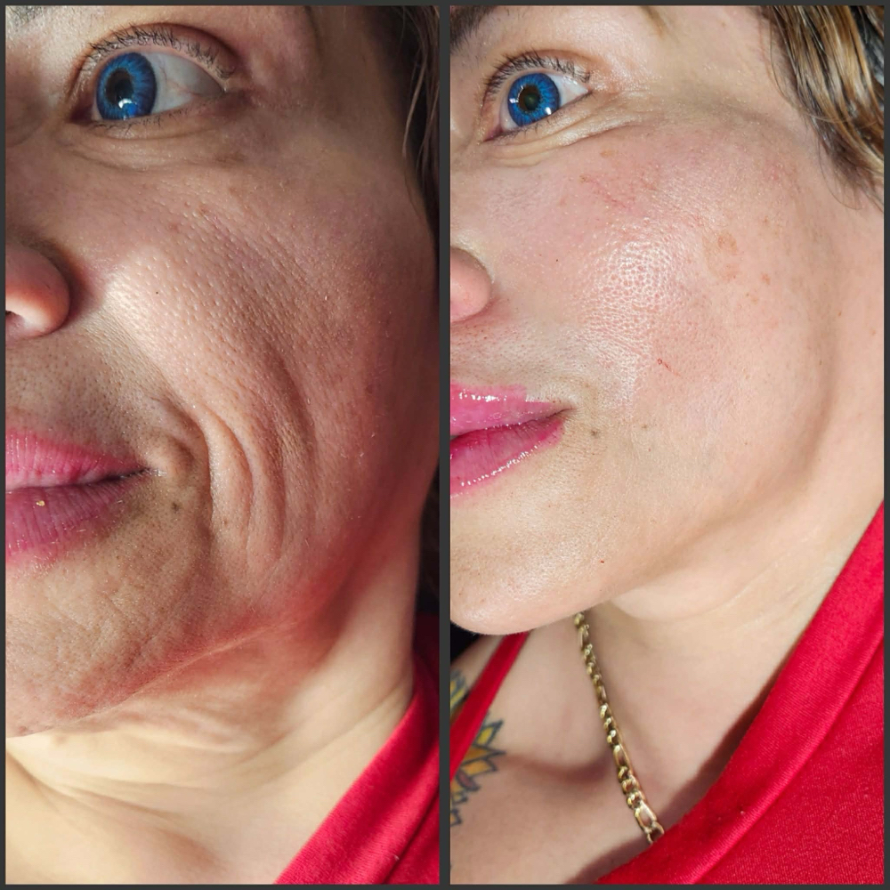 Collagen boost at Pure Bliss Studios in Fort worth, TX