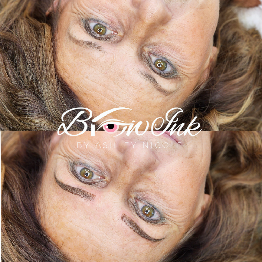 Brow Correction