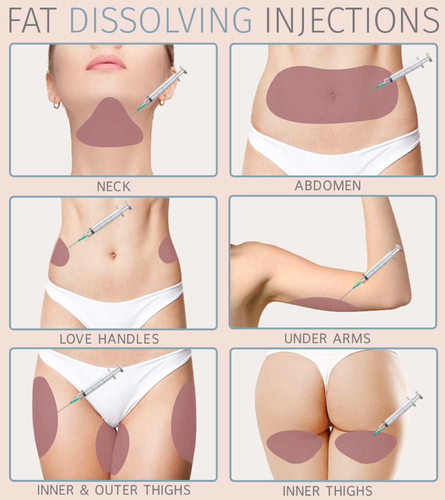 Fat Dissolving Injections