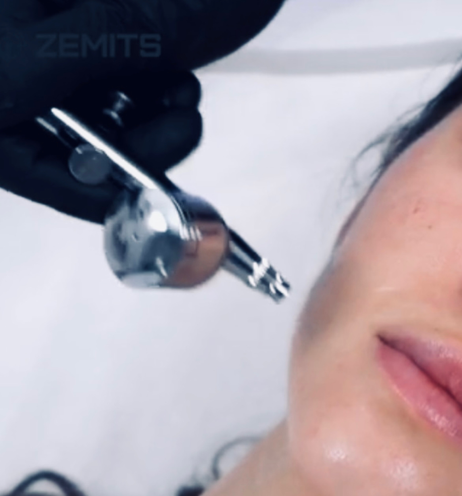Oxygen Facial