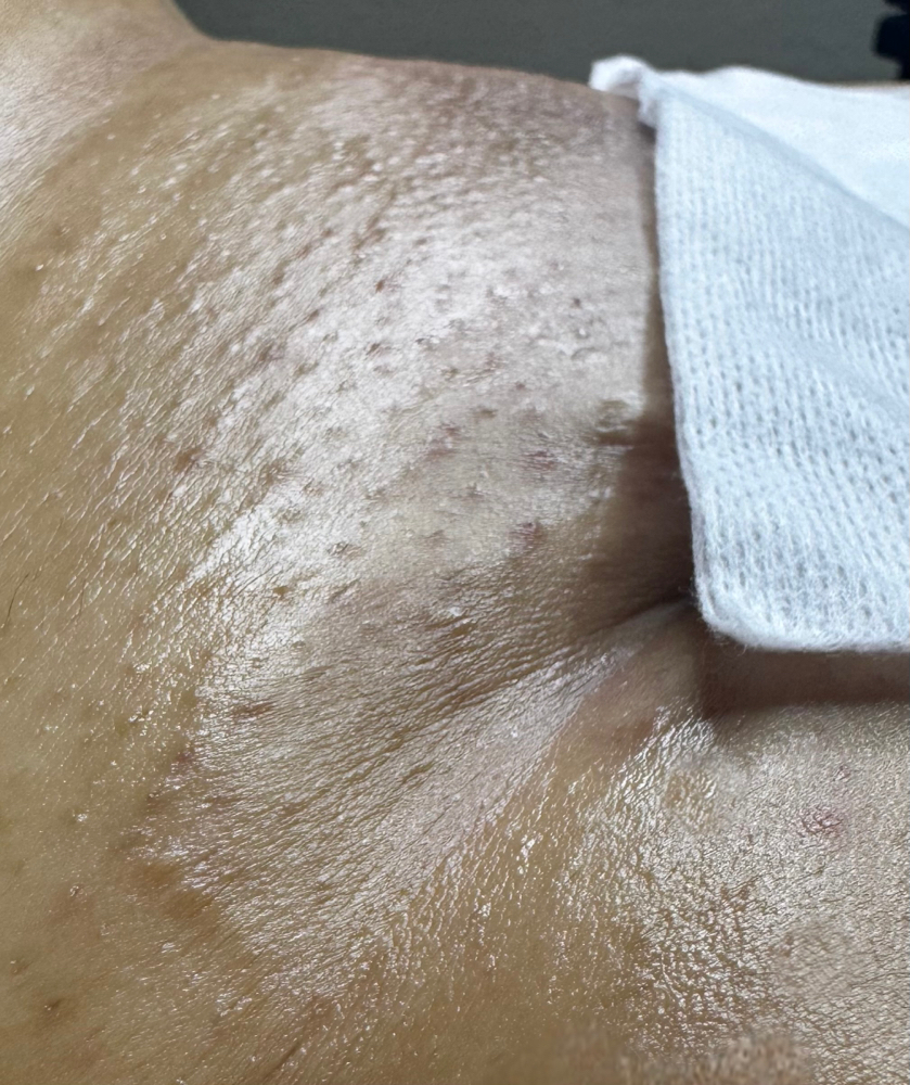 Intimate Waxing