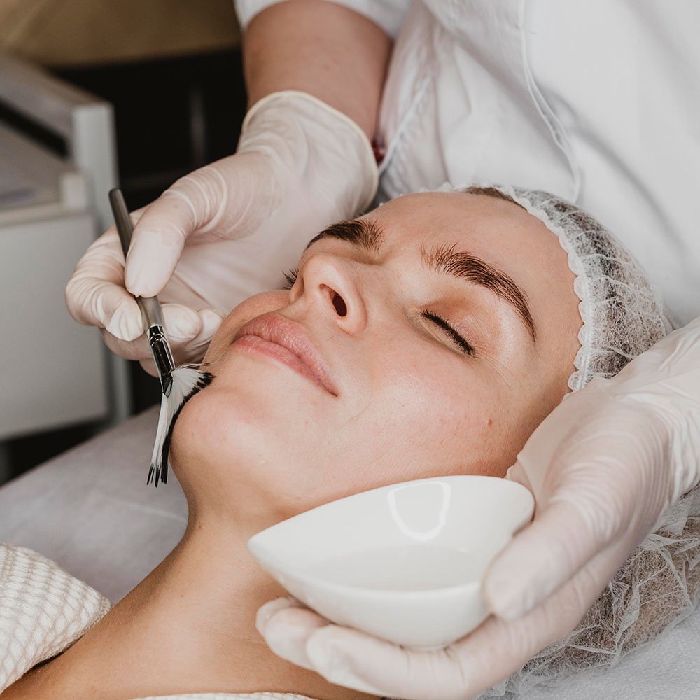 Customized Chemical Peel