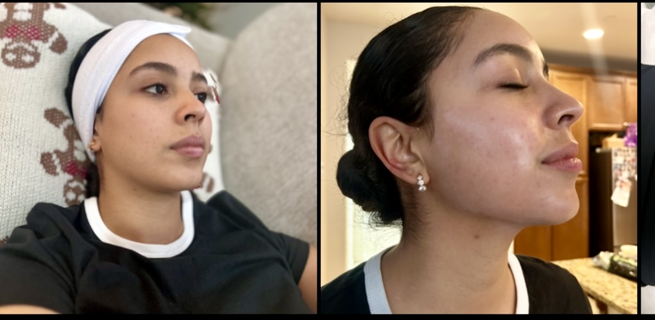 Deep Cleansing Facial (60 Minutes)