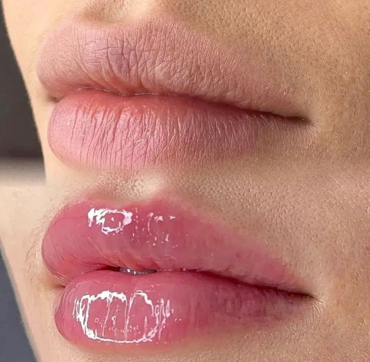Nano Hydra Lips