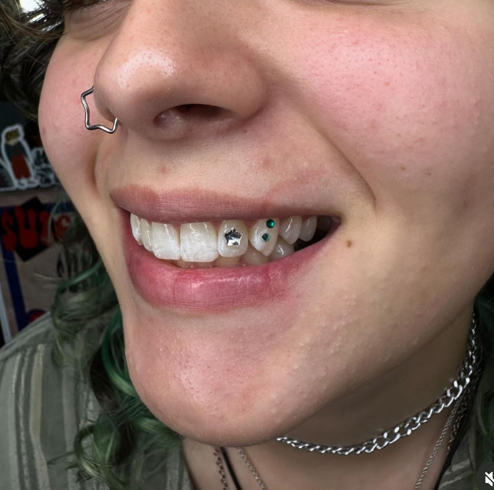 Three Tooth Gems